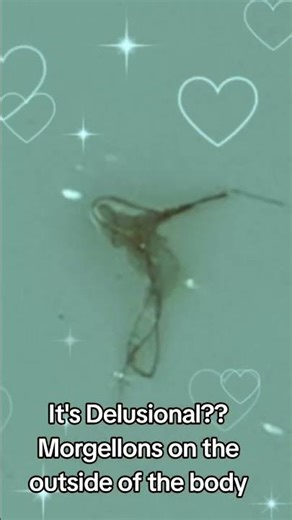 MORGELLONS IS NOT DELUSIONAL