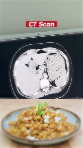 Why Eating Too Fast Is Dangerous 😱 | Chew Slowly for Better Health