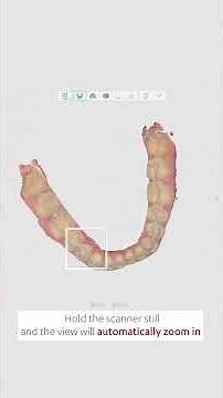 What's New TRIOS & Unite 25.1 #3shape #digitaldentistry