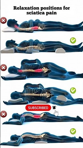 Best vs Worst Sleeping Positions 😲 #spinehealth #posture #sleepbetter #fyp #shorts