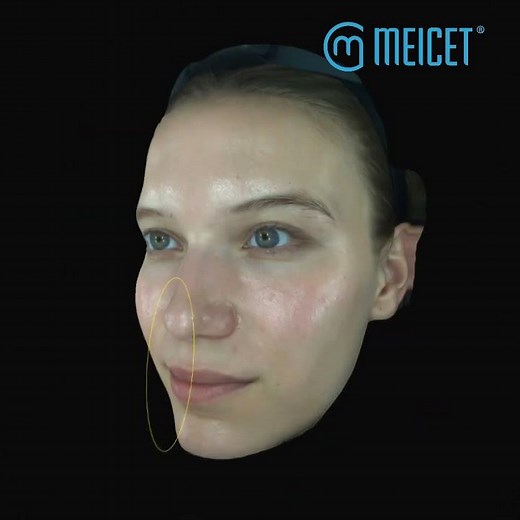Unveiling MEICET's Cutting-Edge 3D D9 Skin Analyzer: Transforming Beauty Analysis #skinanalyzer