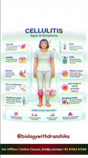 Red, swollen, painful skin? Don’t ignore it—could be cellulitis. #cellulitis #skininfection #neet