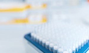 Surveillance Testing & How it Works - Sample Pooling