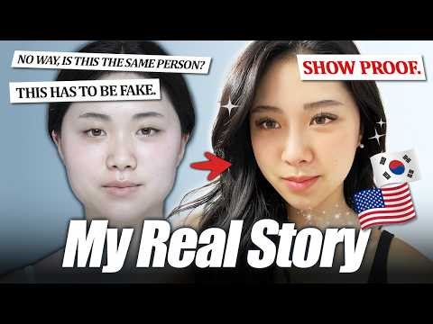 Our Most Popular Surgery Model Ann Lee's FULL Transformation Journey 😱 (1 Year Reveal!)| Braun
