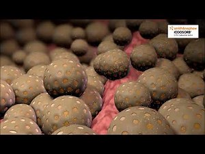 IODOSORB - Der Biofilmbrecher - Mode of Action