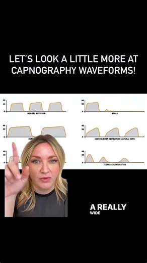 Capnography Waveforms explained!
