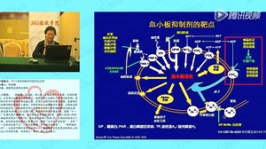 杨丽霞---P2Y12受体抑制剂的规范化应用