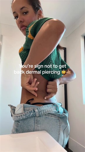 A year later and the dermal still chilling inside my skin ✨ | dermal piercing