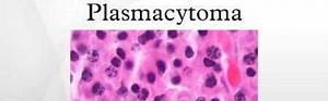 Plasmacytoma Cancer