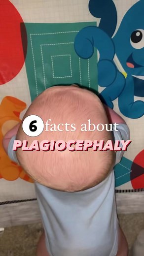 DM “QUIZ” to see if your baby is at risk for this type of flat head! 🙋🏼‍♀️Hey! I’m Brooke — a mom & OT specializing in conservative head shape correction! I’ve helped 400 babies avoid a helmet and I am SO excited to help many more! Plagiocephaly is a medical term that is broken down into meaning “oblique head”. This means the head is slanted in one direction due to flattening on one side! Use these 6 tips to help a) determine if your baby has plagiocephaly b) bring awareness to preventing this