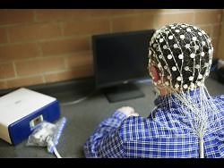 This scan can watch concussion recovery inside your brain