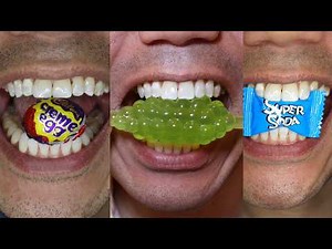 10 Minutes of Satisfying Chewing ASMR #Compilation #ASMR #DoctorTristanPeh