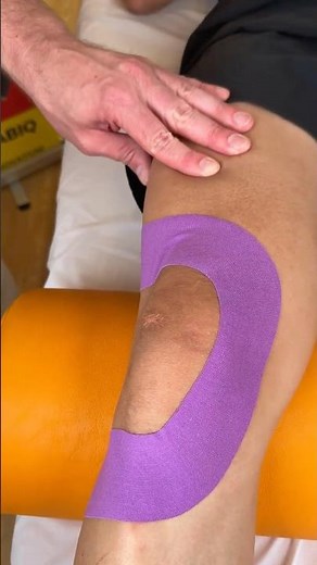 Patellar centering using Temtex Kinesiology Tape.