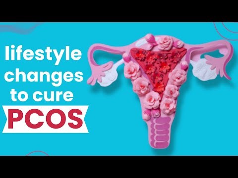PCOS: Easy Ways to Cure and Prevent it Completely!