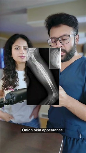 Radiology Signs: High-Yield Imaging Clues