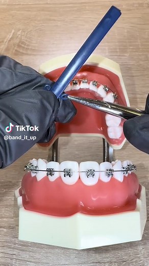 Exploring Navy Blue and Blue Braces Options