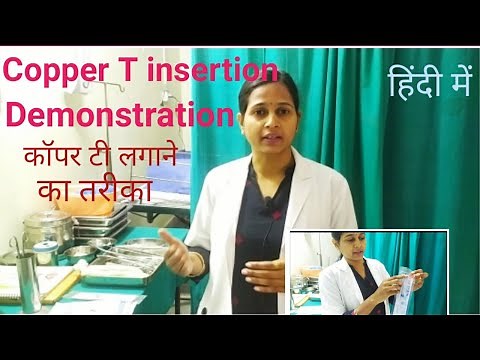 Copper T Insertion Demo/Indication/Contraindication/Side Effects of copper T / by sweta parikh