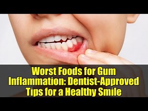 Worst Foods for Gum Inflammation: Dentist-Approved Tips for a Healthy Smile