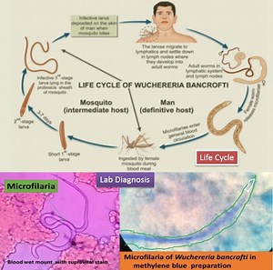 Filariasis: Introduction, classification, Life cycle, clinical features, Lab