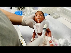 Premature Low Birth Weight Baby First Syringe Feeding | Cute Baby Moments💉🍼