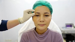 144K views · 721 reactions | #รีวิวFiller #ขมับปรับรูปหน้า...