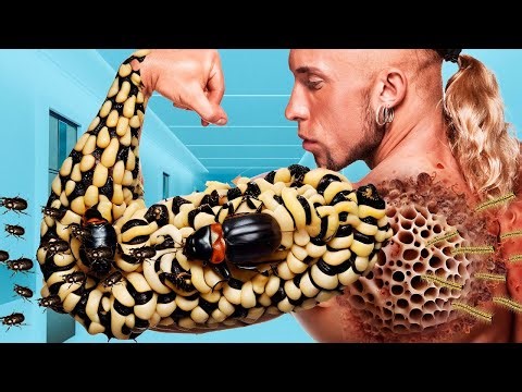 ASMR Animation Treatment | Maggots Removal from biceps of the arm | 2d Deep Cleaning Animation