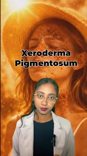One ray is enough | Xeroderma Pigmentosum