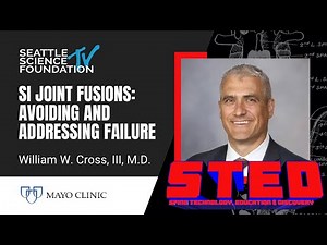 SI Joint Fusions: Addressing and Addressing Failure - William W. Cross III, M.D.