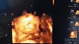 904 reactions · 55 shares | Hi baby! A video snippet from today's 3D/4D scan  | The Birth MD Birthing Center, Medical Clinics, Diagnostics | Facebook