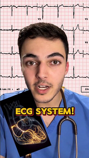 Understanding ECG Basics for Medical Students