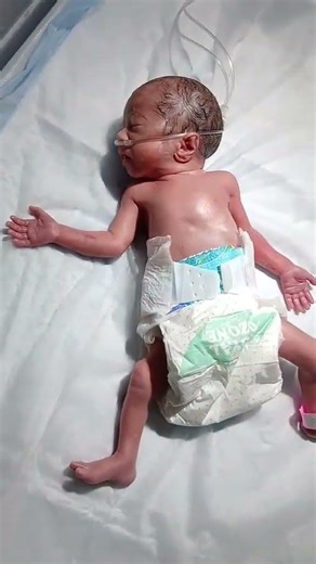 cute newborn 1.2kg. . . . . . #baby #care #professional #nicu #pray #premature #babybehaviorr