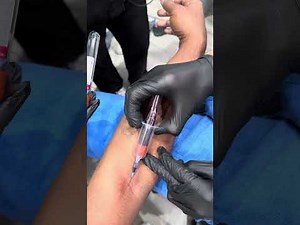 IV Start and Blood Draw