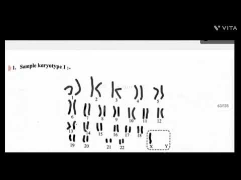 12th Bio: Experiment no.15: To study various syndrome and their karyotypes in human beings.
