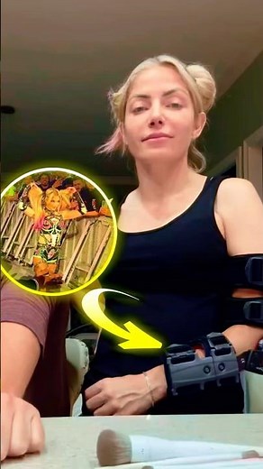 Why Alexa Bliss Is FORCED To Wear An Arm Brace
