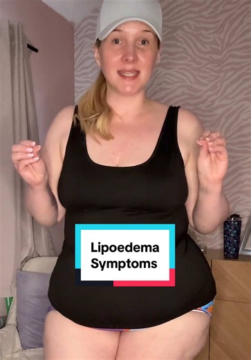 Understanding Lipoedema: Key Symptoms You Should Know