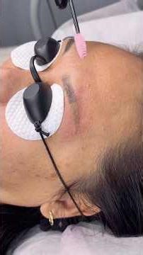 Eyebrow tattoo removal process #browstylist #microblading #laserremoval #laser