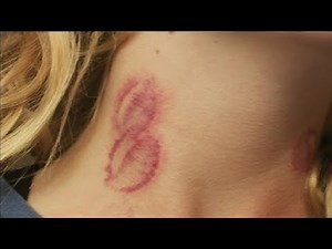 HOW TO GIVE A HICKEY WORKS EVERY SINGLE TIME in ONLY 1 MINUTE