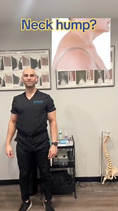 Neck hump? Try this and share! Neck humps can have various causes such as Cushing’s Syndrome. If it’s due to posture, this exercise may help! #neckhump #dowagershump #posture #postura #tips #fyp #helpful #viral #posturetips #posturecorrection | Prime Performance Chiropractic & Wellness Clinic