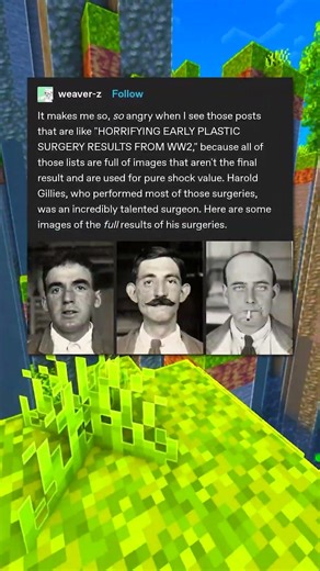 Early Plastic Surgery 🎭