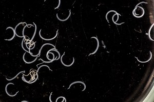 These Terrifying Parasites Feed on Humans