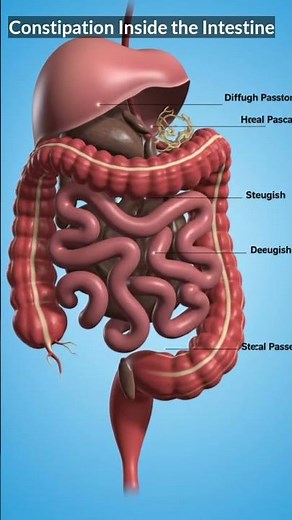 What Constipation Looks Like Inside Your Body | Stool Movement Animation