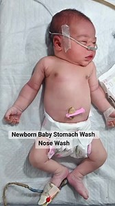 Newborn Baby Stomach Wash _ Nose Wash _ Cleaning_ RBS Checkup_ Warmer Care _ Initial Assessment #newborn #preterm #babycare #usa #unfreezmyaccount