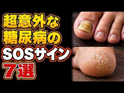 糖尿病の足に出る危険サイン7つ｜足の裏を見ていますか？しびれ・冷え・治らない傷を見逃さないで