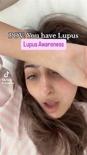 873 reactions · 339 shares | 曆 #lupus #lupusawareness...