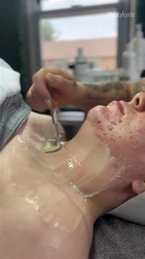 ✨ Tackling Acne with DMK Enzyme Therapy ✨ DMK’s Enzyme Therapy is...