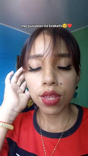 Brakets: La Experiencia de Un Nuevo Cambio