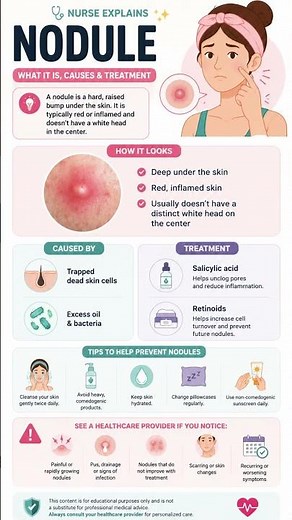 Skin Nodules Explained: Causes, Symptoms & Treatment #nurseexplains