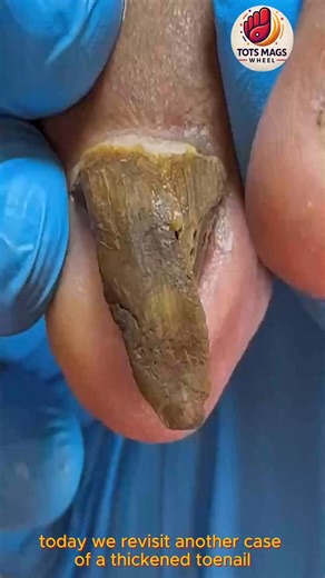 343K views · 1K reactions | Smart Wellness Tips for Men Over 60 to Stay Active Comfortably #FootWellnessUSA #EverydayCare #SimpleHealthTricks | Tots Mags Wheel | Facebook