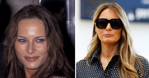 Plastic surgeons weigh in on Melania Trump’s face