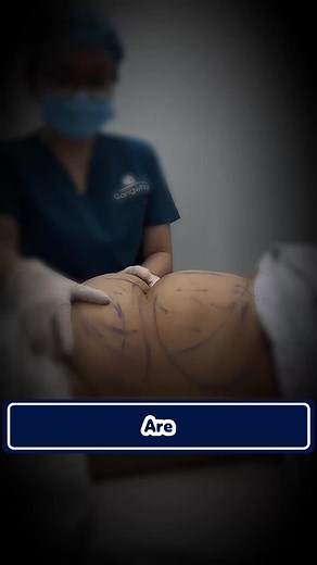 3 comments | Learn more about ultrasonic fat reduction | Brandora | Facebook